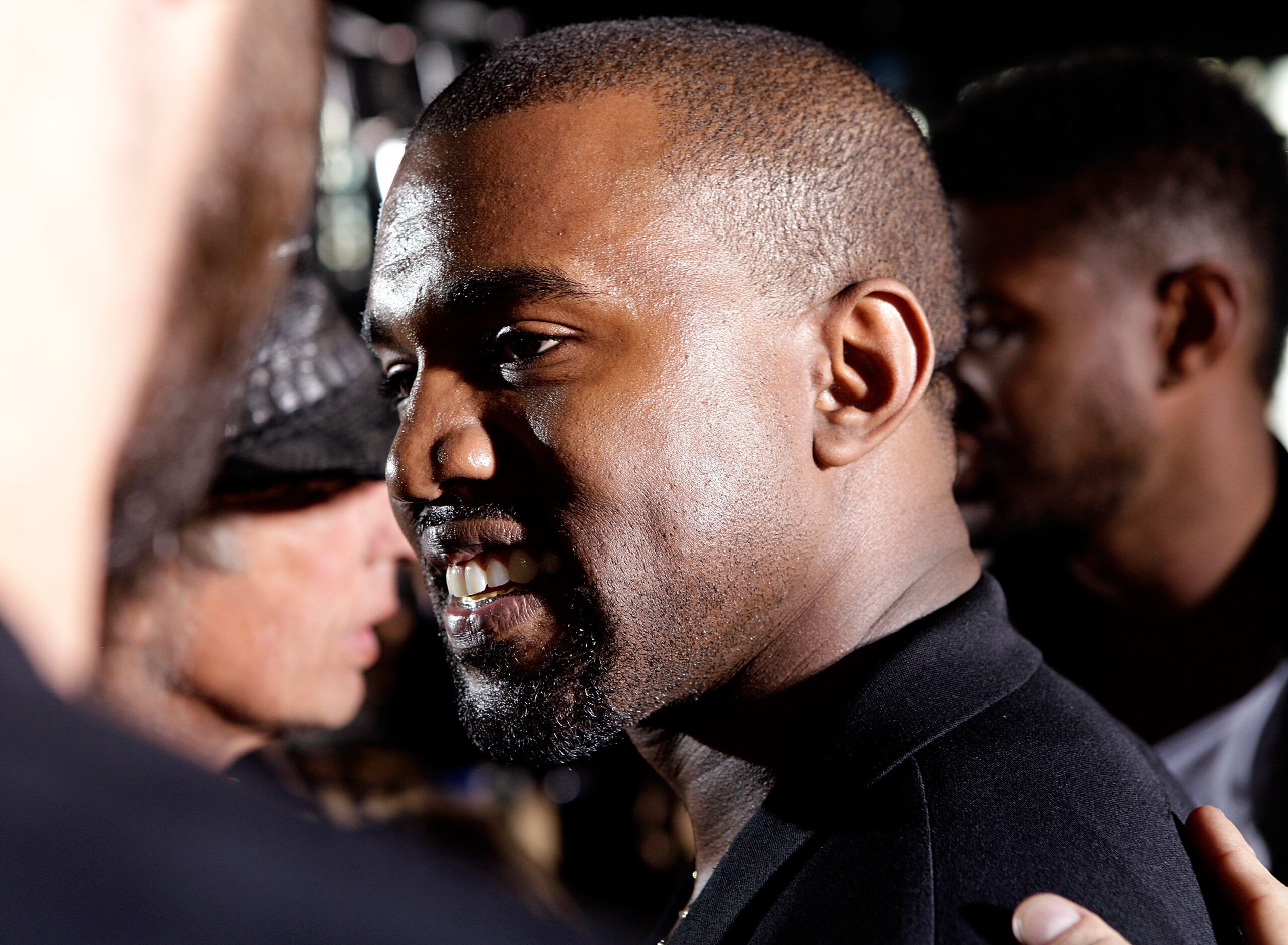 Ye 측 법률 대리인, 손가락이 절단된 증인 향해 조롱 논란